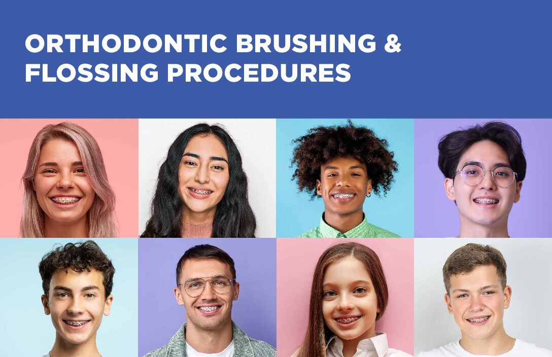 (Item # 440-204B) Orthodontic Brushing and Flossing Procedures - Packs of 100