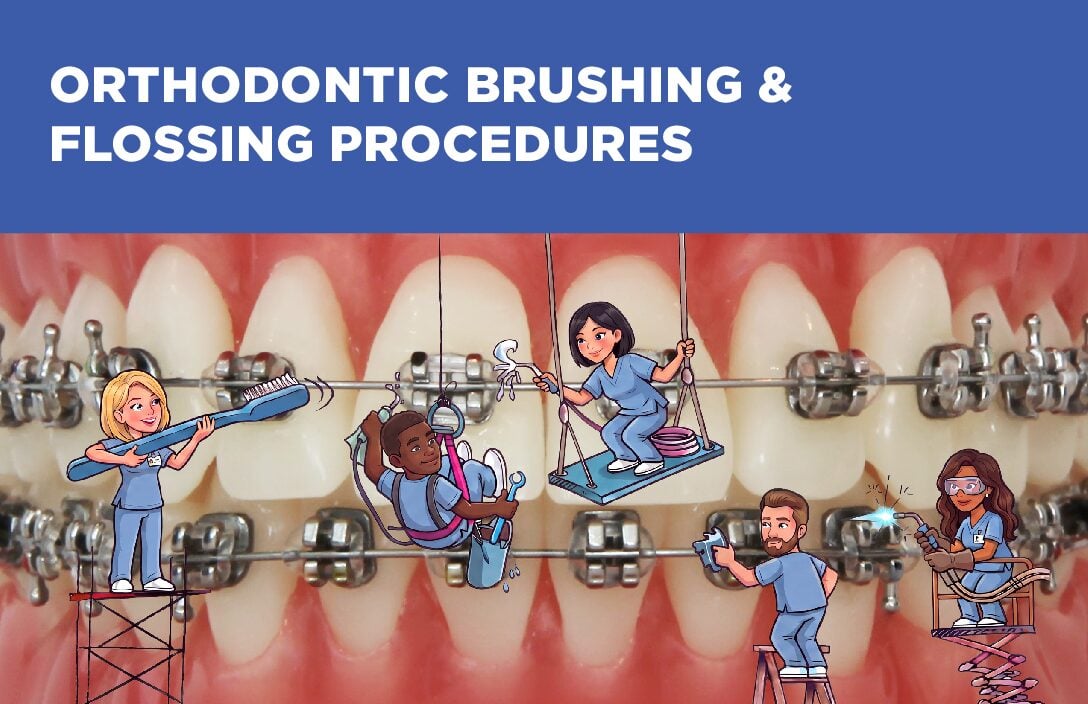 (Item # 440-204) Orthodontic Brushing and Flossing Procedures - Packs of 100