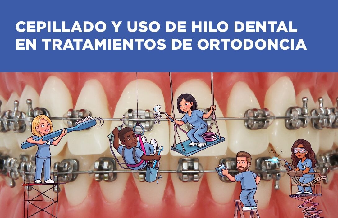 (Item # 440-210) Orthodontic Brushing and Flossing Procedures (Spanish) - Packs of 100