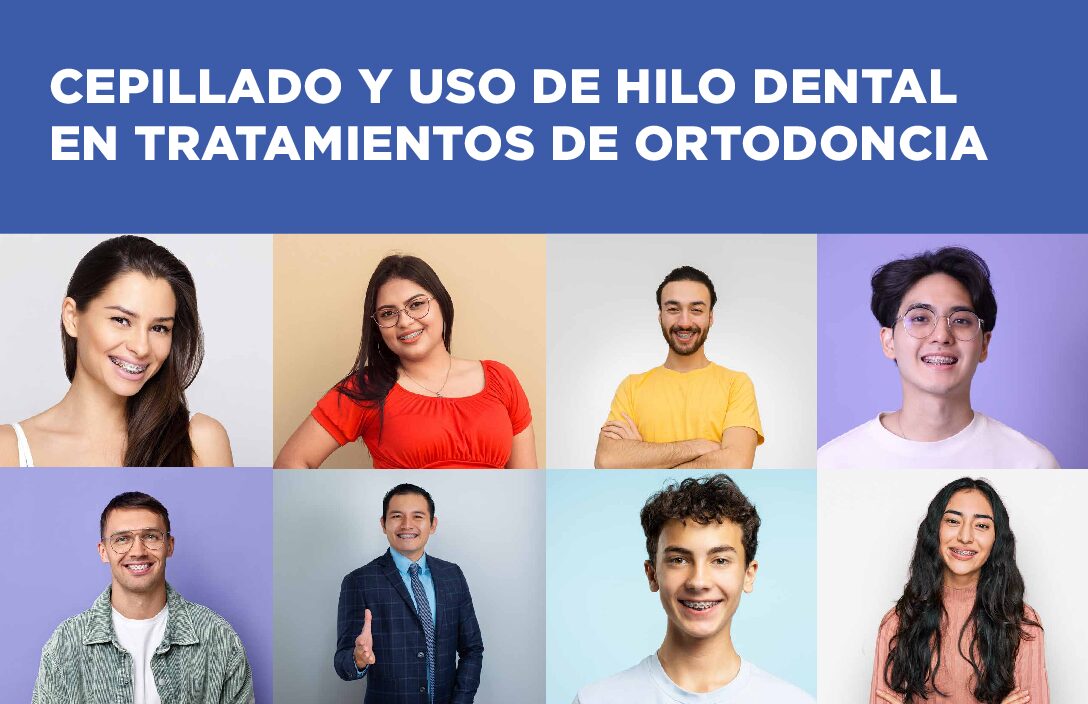 (Item # 440-210) Orthodontic Brushing and Flossing Procedures (Spanish) - Packs of 100