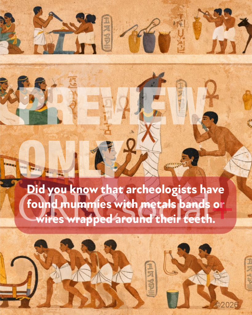 Braces History Fact