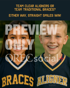 Aligners vs. Braces