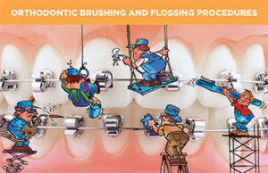 (Item # 430-103) Orthodontic Brushing and Flossing Procedures with Self-Ligating Brackets - Packs of 100