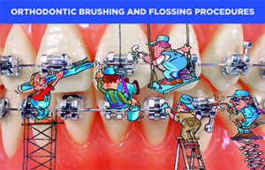 (Item # 440-204) Orthodontic Brushing and Flossing Procedures - Packs of 100