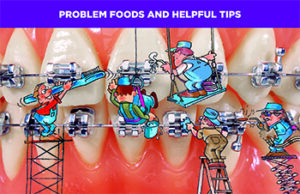 (Item # 440-209) Problem Foods and Helpful Tips - Packs of 100