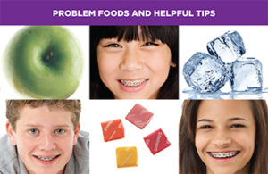 (Item # 440-209A) Problem Foods and Helpful Tips - Packs of 100