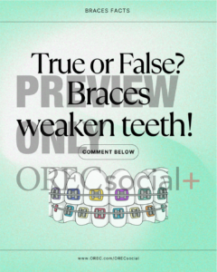 True or False: Braces Weaken Teeth?